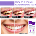 New 7-Pro Intensive Toothpaste | Upgraded Purple Formula with 7 Probiotics | Deep Enamel Repair & Long-Lasting Freshness