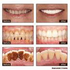 New 7-Pro Intensive Toothpaste | Upgraded Purple Formula with 7 Probiotics | Deep Enamel Repair & Long-Lasting Freshness